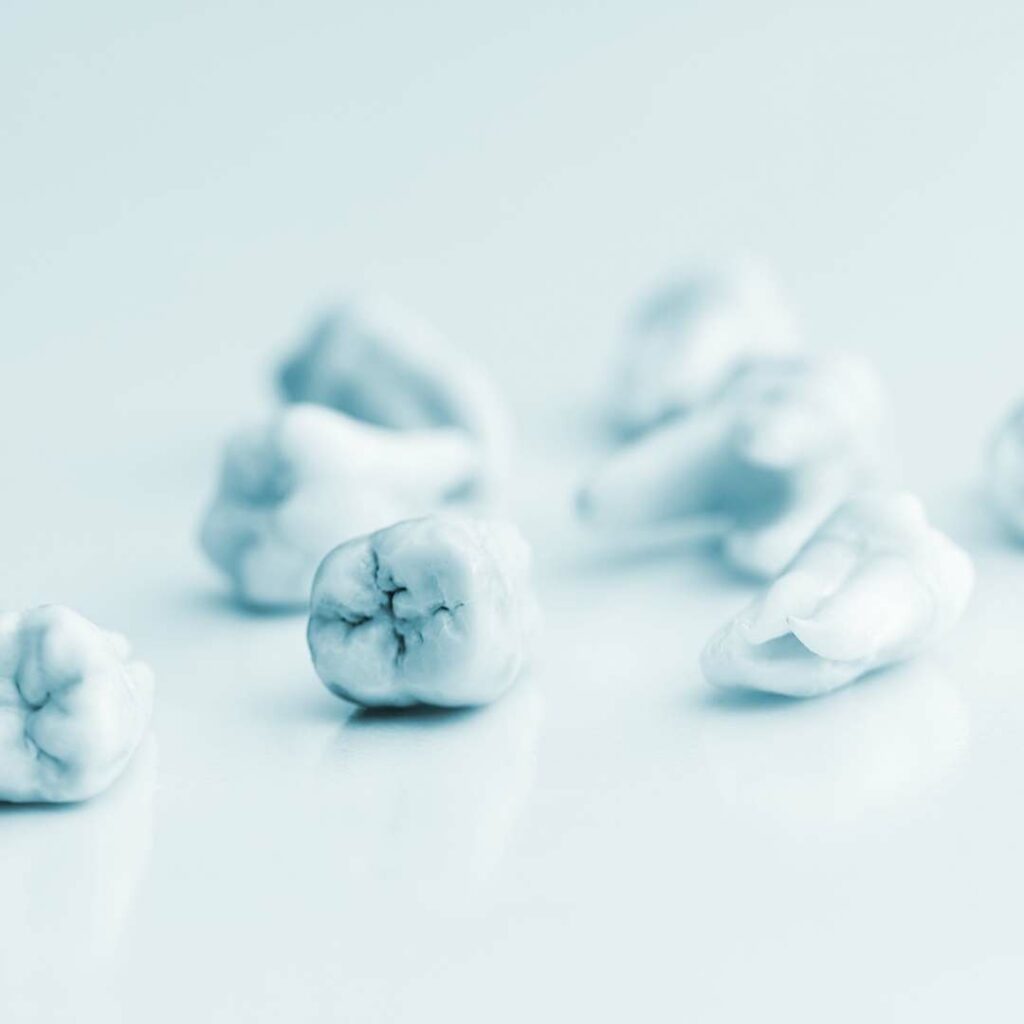 White Fillings FAQs
